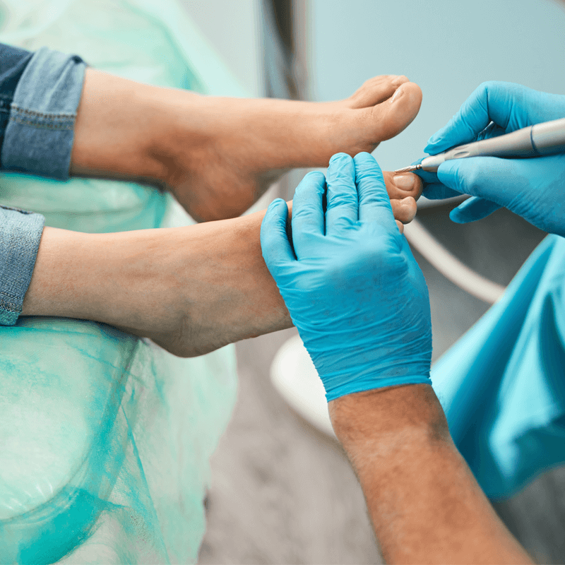 footcare treatment